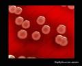 staphylococcus aureus